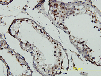 GTF2H1 monoclonal antibody (M01), clone 1F12-1B5