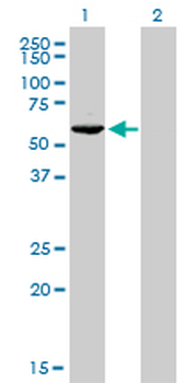 GTF2H1 monoclonal antibody (M01), clone 1F12-1B5