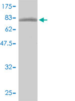 GTF2H1 monoclonal antibody (M01), clone 1F12-1B5