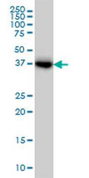 GLUL monoclonal antibody (M02), clone 3B6