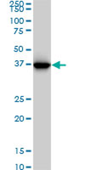 GLUL monoclonal antibody (M02), clone 3B6