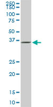 GLUL monoclonal antibody (M02), clone 3B6