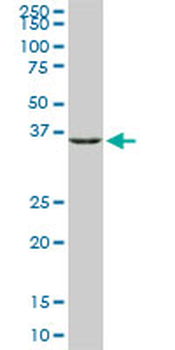 GLUL monoclonal antibody (M02), clone 3B6