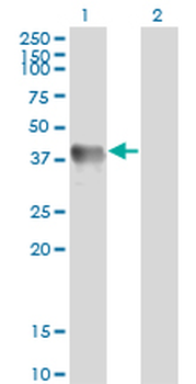 GLUL monoclonal antibody (M02), clone 3B6