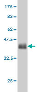 GLUL monoclonal antibody (M02), clone 3B6