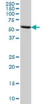 FKBP4 monoclonal antibody (M01), clone 5C11