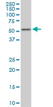 FKBP4 monoclonal antibody (M01), clone 5C11