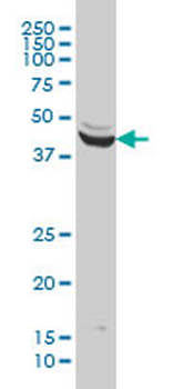 ENO3 monoclonal antibody (M01), clone 5D1