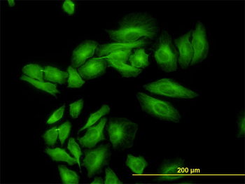 ENO3 monoclonal antibody (M01), clone 5D1