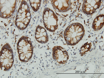 ENO3 monoclonal antibody (M01), clone 5D1