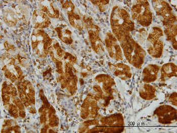 ENO3 monoclonal antibody (M01), clone 5D1