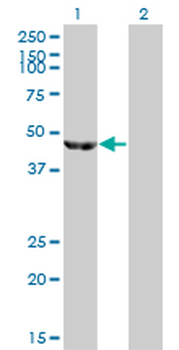 ENO3 monoclonal antibody (M01), clone 5D1