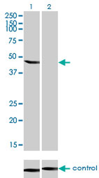 ENO3 monoclonal antibody (M01), clone 5D1