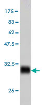 ENO3 monoclonal antibody (M01), clone 5D1