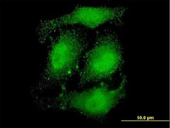 ATN1 monoclonal antibody (M01), clone 2C10