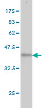 ATN1 monoclonal antibody (M01), clone 2C10