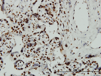 ARID3A monoclonal antibody (M01), clone 1A11