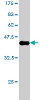 DIAPH1 monoclonal antibody (M01), clone 5A8