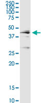 CTSD purified MaxPab rabbit polyclonal antibody (D01P)