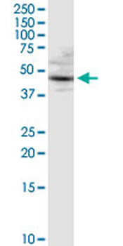 CTSD purified MaxPab rabbit polyclonal antibody (D01P)