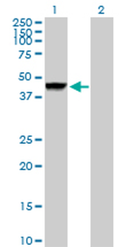 CTSD purified MaxPab rabbit polyclonal antibody (D01P)