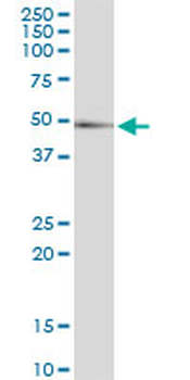 CTSD MaxPab rabbit polyclonal antibody (D01)