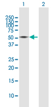 CTSD MaxPab rabbit polyclonal antibody (D01)