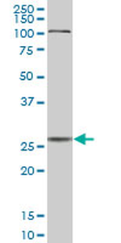 CTSD purified MaxPab mouse polyclonal antibody (B01P)