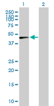 CTSD purified MaxPab mouse polyclonal antibody (B01P)