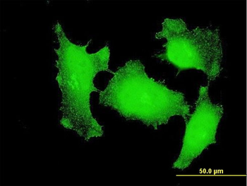 CTNNB1 monoclonal antibody (M02), clone 1C9