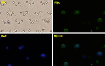 CTNNB1 monoclonal antibody (M02), clone 1C9