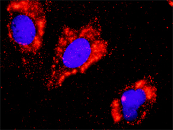 CTNNB1 monoclonal antibody (M02), clone 1C9