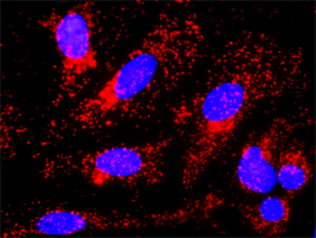 CTNNB1 monoclonal antibody (M02), clone 1C9