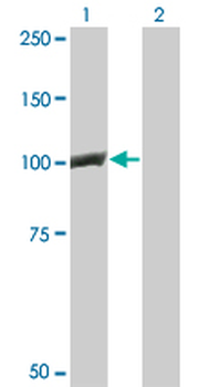 CTNNB1 monoclonal antibody (M02), clone 1C9