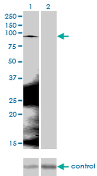 CTNNB1 monoclonal antibody (M02), clone 1C9