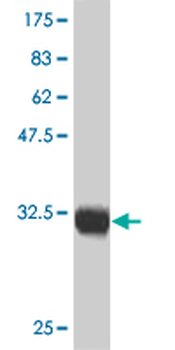 CTNNB1 monoclonal antibody (M02), clone 1C9