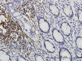 CSK monoclonal antibody (M01), clone 3A3