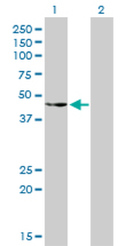 CSK monoclonal antibody (M01), clone 3A3