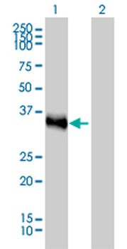 CRX monoclonal antibody (M02), clone 4G11