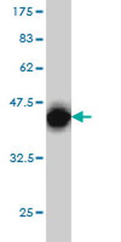 CRX monoclonal antibody (M02), clone 4G11