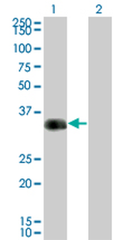 CRX monoclonal antibody (M01), clone F6-C2