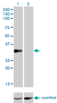 CRX monoclonal antibody (M01), clone F6-C2