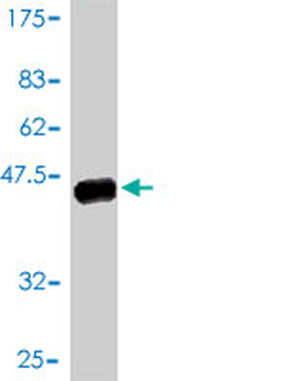 CRX monoclonal antibody (M01), clone F6-C2