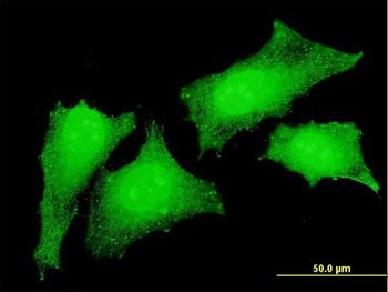 CRKL monoclonal antibody (M03), clone 4B5