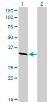 CRKL monoclonal antibody (M03), clone 4B5