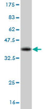 CRKL monoclonal antibody (M03), clone 4B5