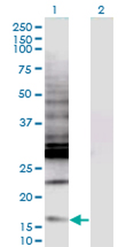 CREBL2 monoclonal antibody (M04), clone 1C1