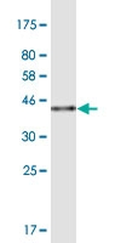 CREBL2 monoclonal antibody (M04), clone 1C1