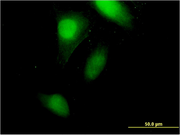 CRABP2 monoclonal antibody (M01), clone 4F2