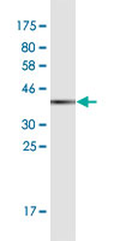 CRABP2 monoclonal antibody (M01), clone 4F2